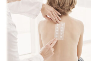 Read more about the article PATCH TEST U ALERGOLOŠKOJ DIJAGNOSTICI