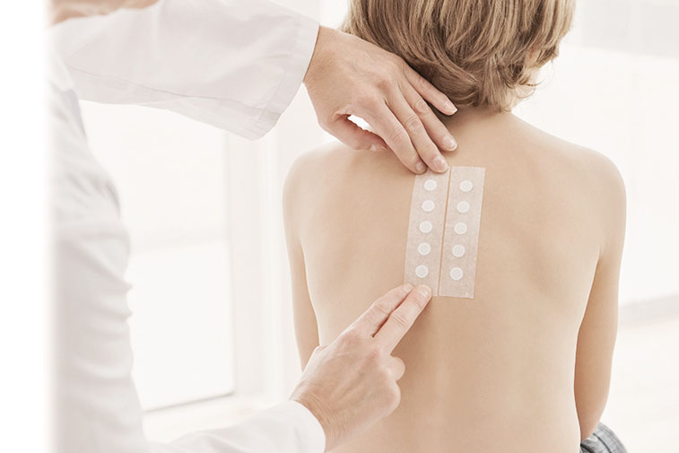 Read more about the article PATCH TEST U ALERGOLOŠKOJ DIJAGNOSTICI
